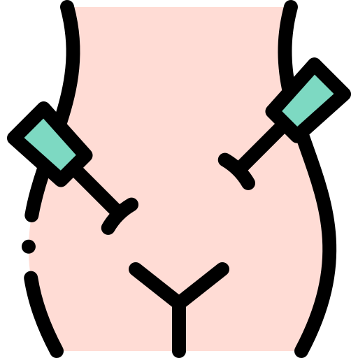 LAPAROSCOPY